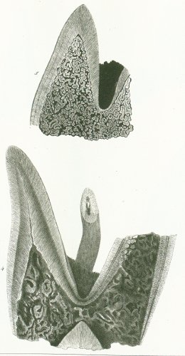 Diplodus gibbosus Tafel M 2 fig. 4-5