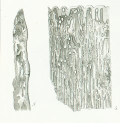 Ctenoptychius denticulatus Tafel M fig. 4, 5